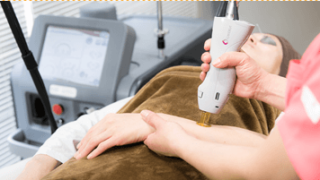 医療レーザー脱毛